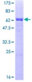 SDS-PAGE (EIF2S1-3172H).jpg